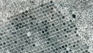 adenovirus in tissue culture - paracrystalline formation